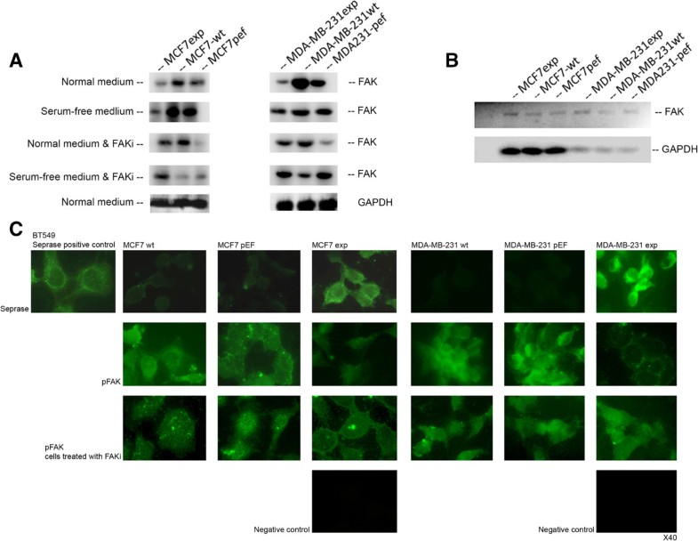 FAPα (Fibroblast activation proteinα) is involved in the control of