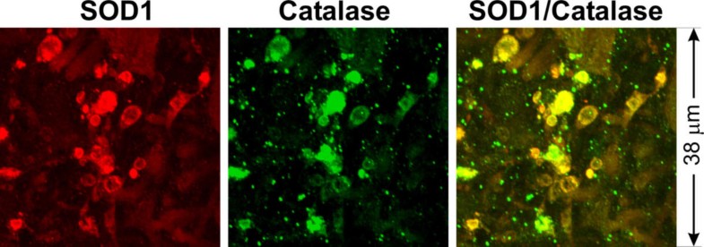 ALS-associated mutant SOD1G93A causes mitochondrial vacuolation by