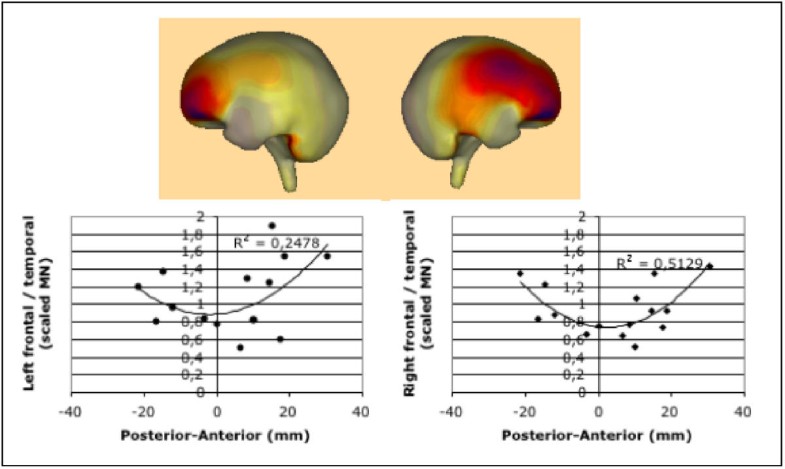 mr of th e normal and abnormal internal auditory canal mr of th e normal and abnormal internal auditory canal