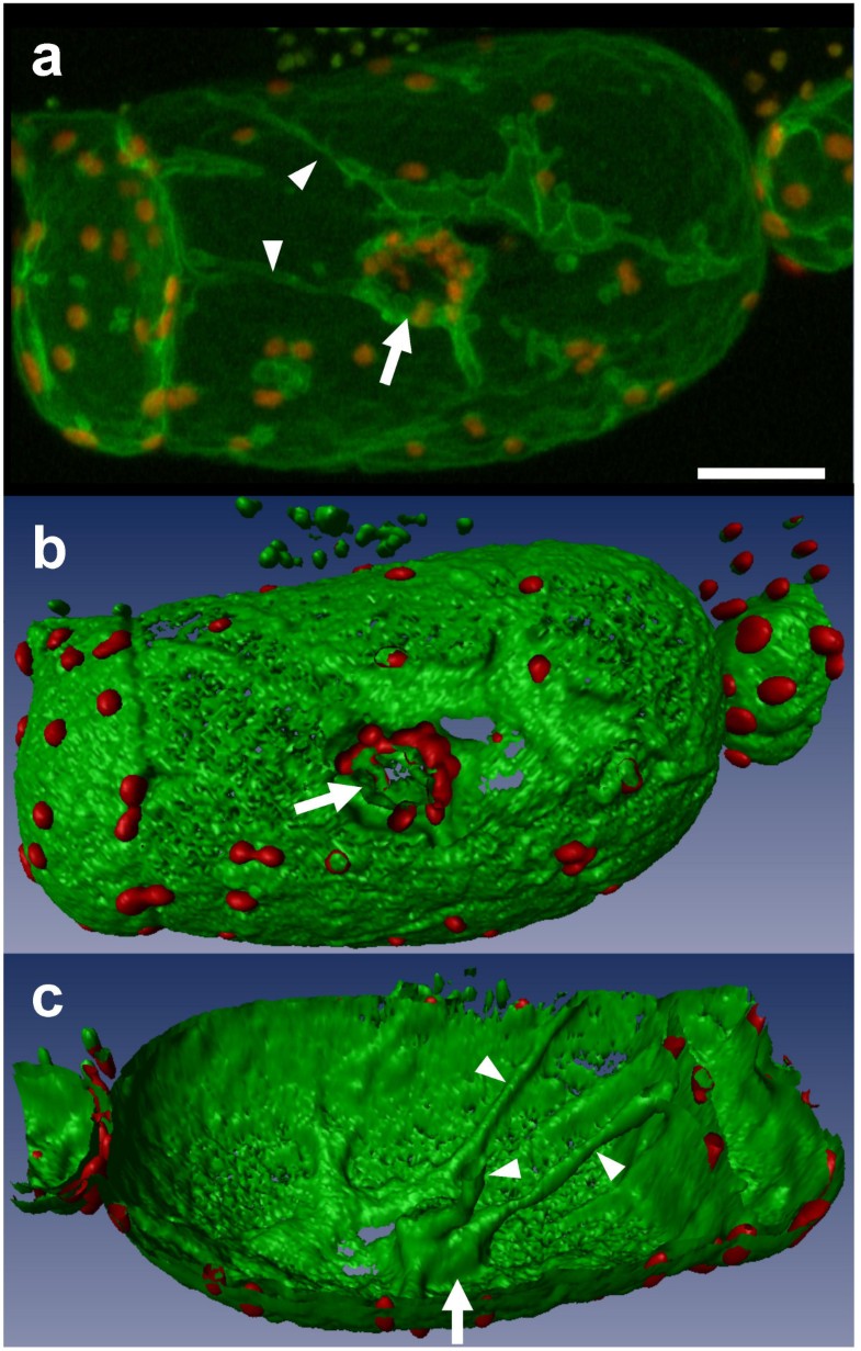 New insights into the tonoplast architecture of plant vacuoles and