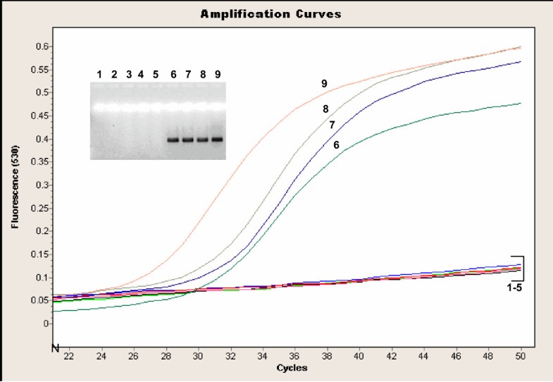 Evaluation of realtime PCR for diagnosis of Bordetella pertussis
