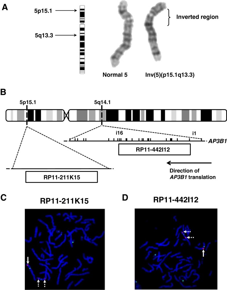 Disruption of AP3B1by a chromosome 5 inversion: a new disease mechanism