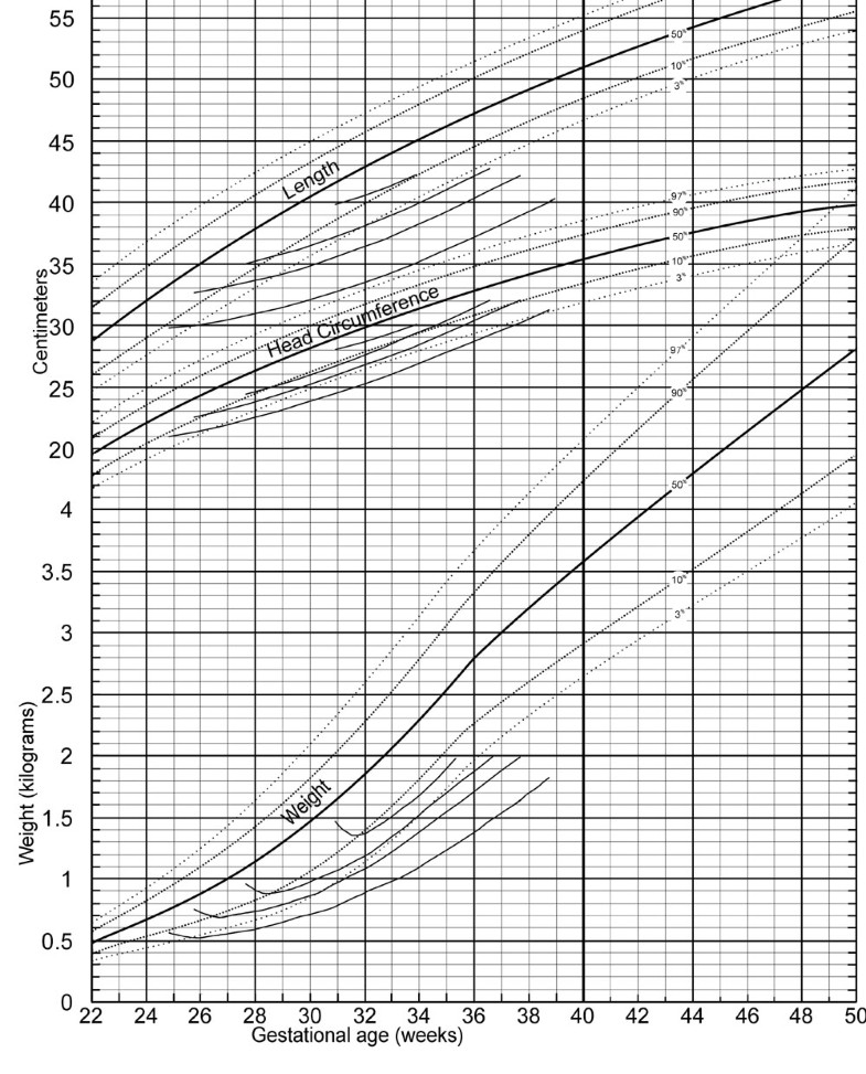 A new growth chart for preterm babies: Babson and Benda's chart updated ...