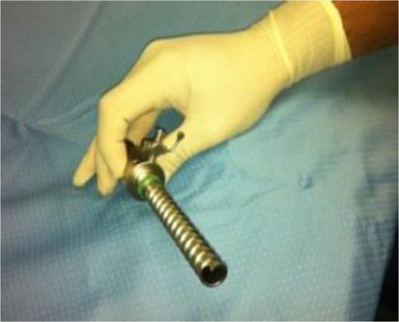 Bilateral spermatic cord en bloc ligation by laparoendoscopic single