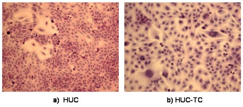 Transformation of SV40-immortalized human uroepithelial cells by 3