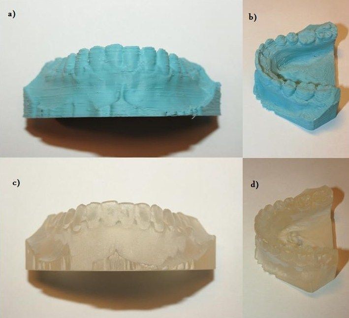 Possibility of reconstruction of dental plaster cast from 3D digital study models BioMedical