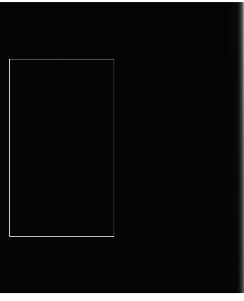 change cm to mm xscan radiology change cm to mm xscan radiology