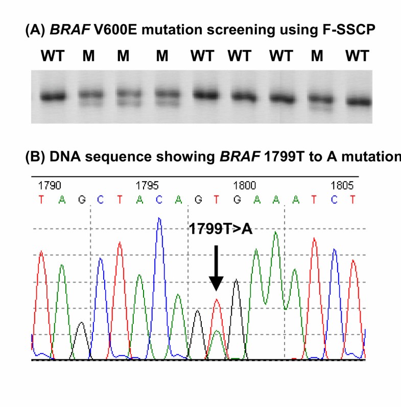 BRAF mutations are associated with distinctive clinical, pathological