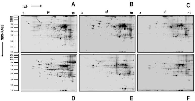 Age-related subproteomic analysis of mouse liver and kidney peroxisomes