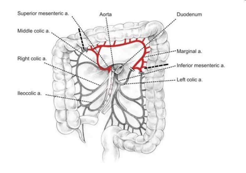 Gastric tube resection due to metachronic cancer and a recurrence in ...