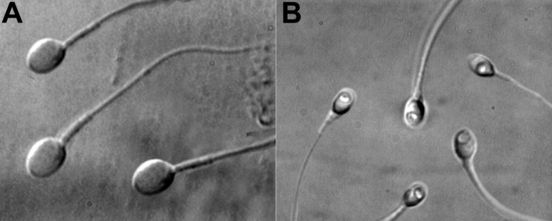 efficacy-of-the-motile-sperm-organelle-morphology-examination-msome