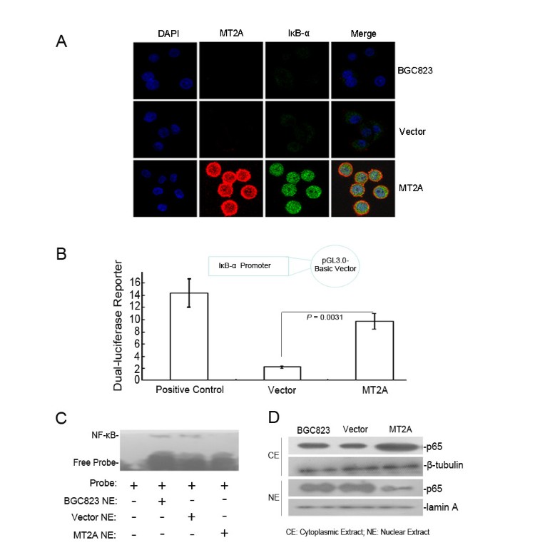 Metallothionein 2A inhibits NF-κB pathway activation and 