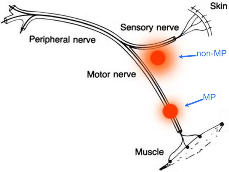 Muscle motor point identification is essential for optimizing