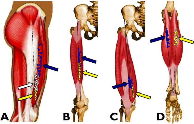 Muscle motor point identification is essential for optimizing