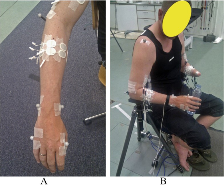 EMGbased simultaneous and proportional estimation of wrist/hand