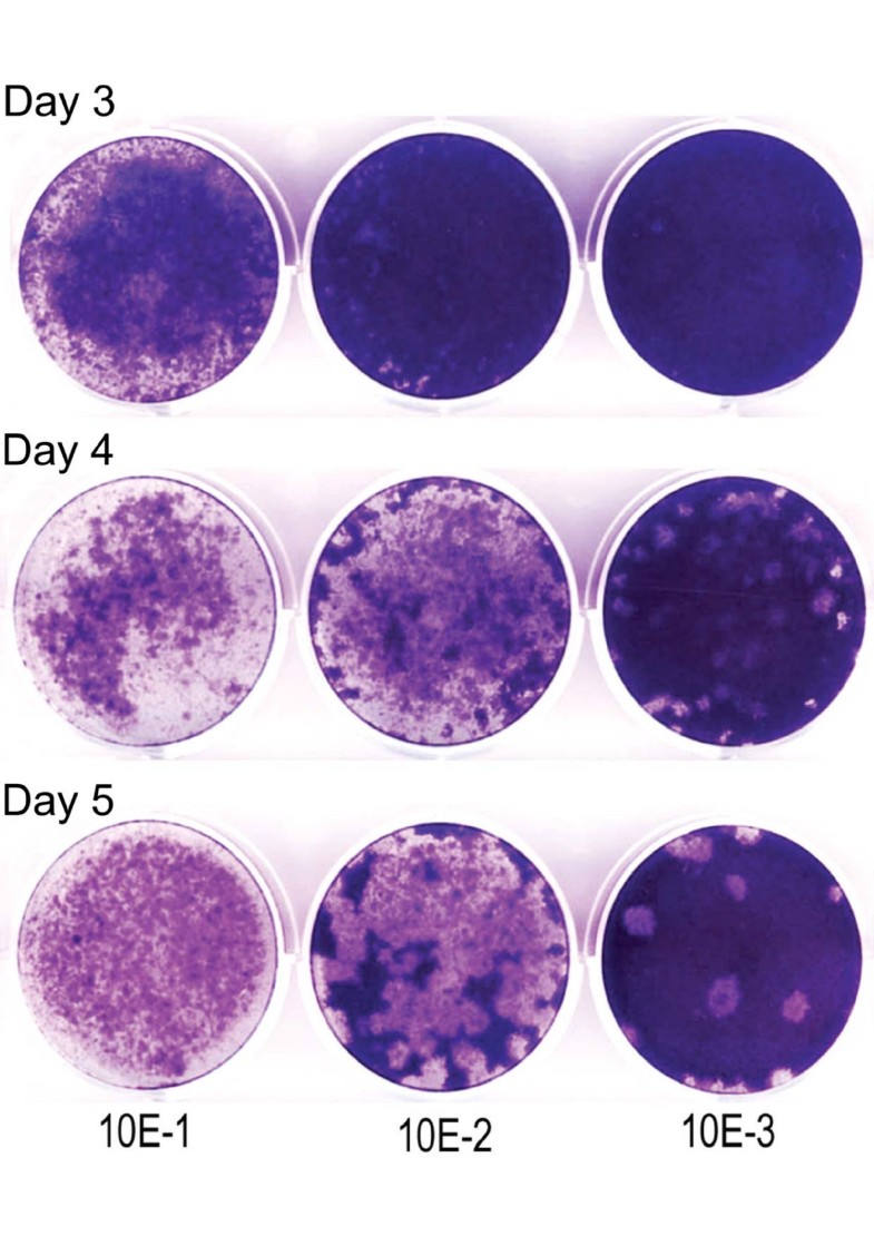 Plaque assay for human coronavirus NL63 using human colon carcinoma