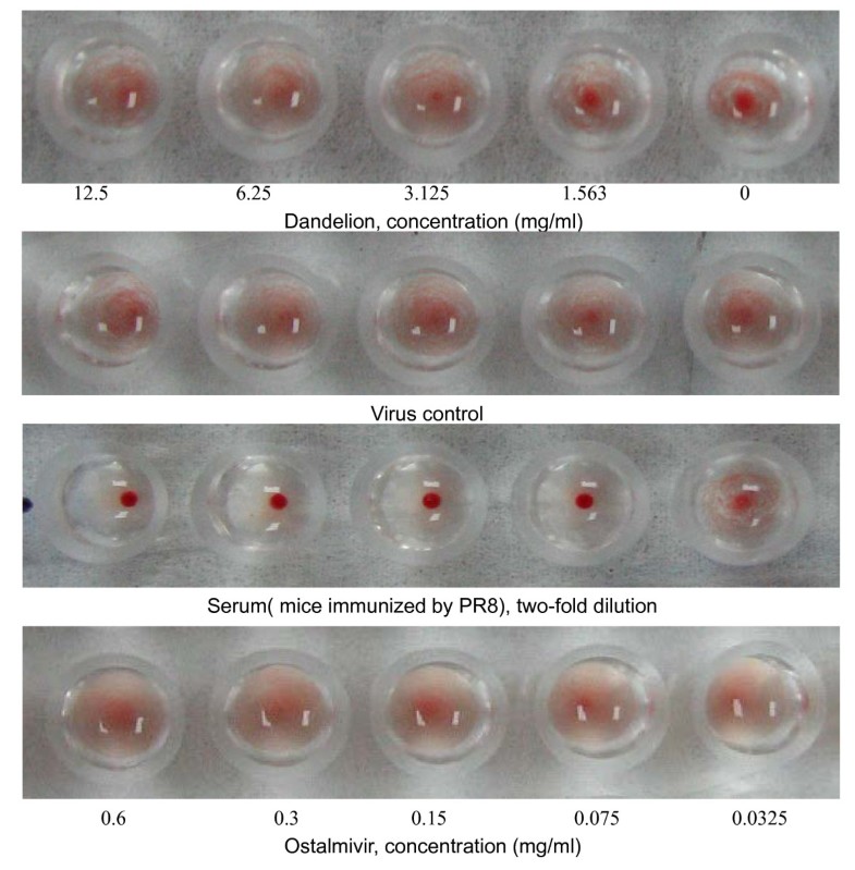 Anti-influenza virus effect of aqueous extracts from dandelion