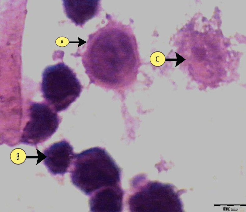 count nuclei imagej count nuclei imagej
