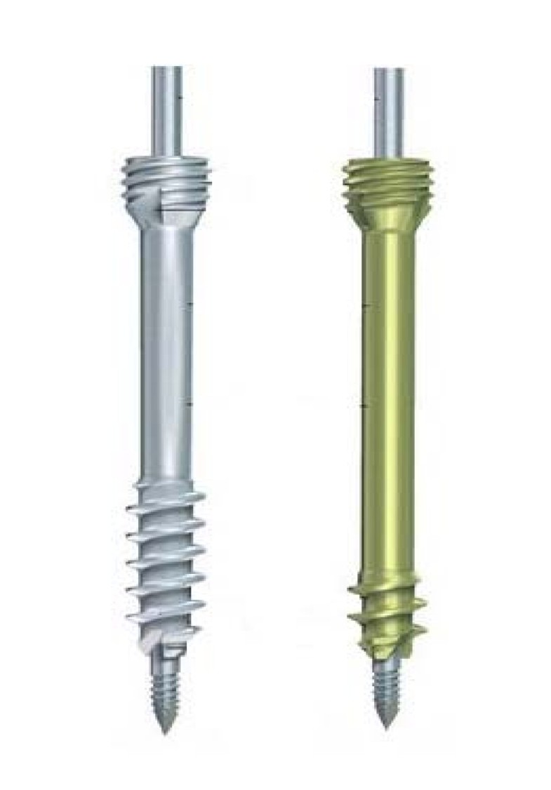 A comparison of two headless compression screws for operative treatment