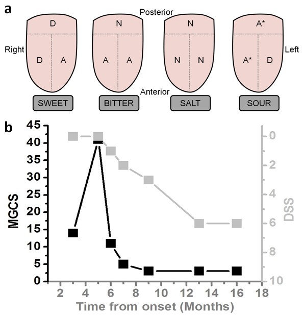 Sweet taste loss in myasthenia gravis more than a coincidence