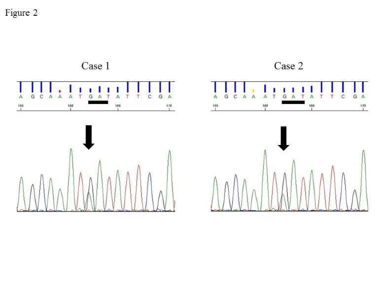 Novel missense mutation in the FH gene in familial renal cell cancer