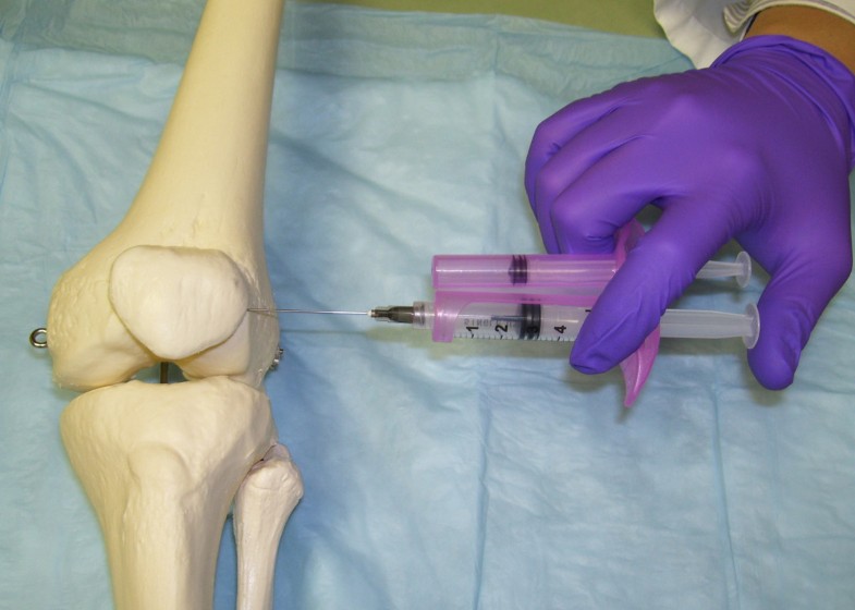 The highly accurate anteriolateral portal for injecting the knee BMC