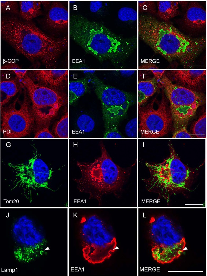 Monoubiquitination of EEA1 regulates endosome fusion and trafficking