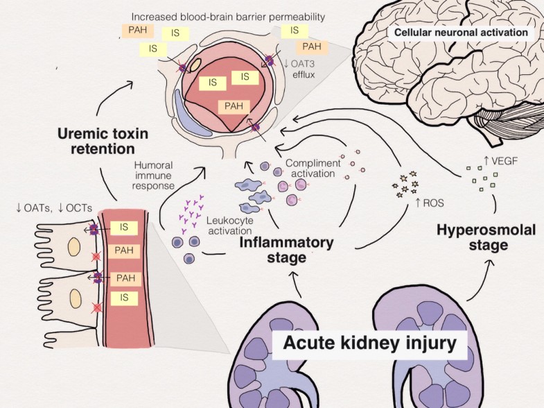 Brainkidney crosstalk Critical Care Full Text