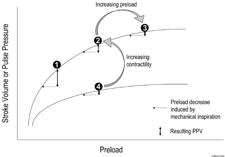 Pulse pressure variation beyond the fluid management of patients with