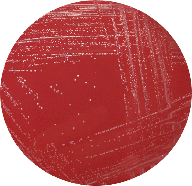 Leptotrichia trevisanii bacteremia in a woman with systemic lupus