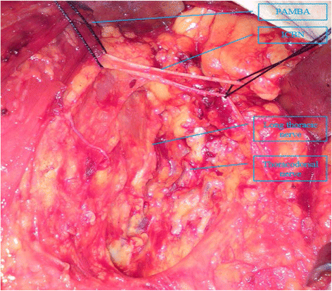 Partial axillary lymph node dissection inferior to the
