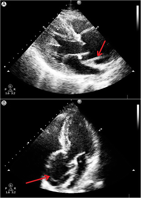Feasibility and accuracy of bedside transthoracic echocardiography in