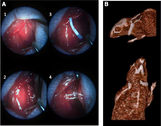 Electric stimulation of the vagus nerve reduced mouse neuroinflammation