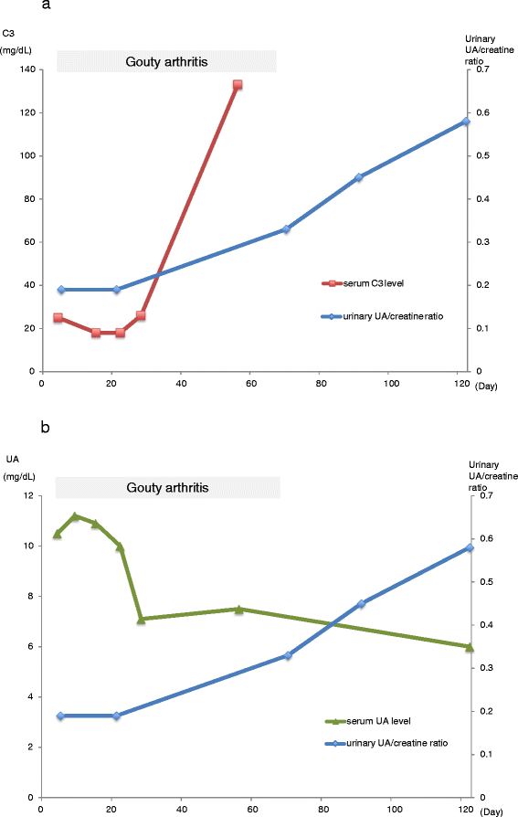Poststreptococcal acute glomerulonephritis complicated by gouty