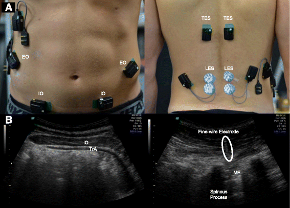 emg cervical spine