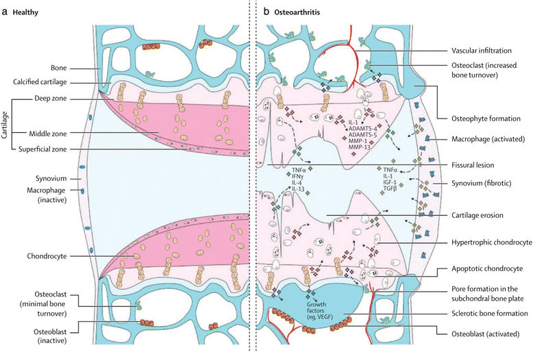 Animal models of osteoarthritis classification, update, and