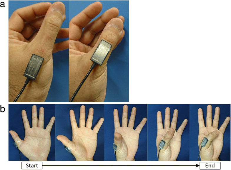 A new method of measuring the thumb pronation and palmar abduction