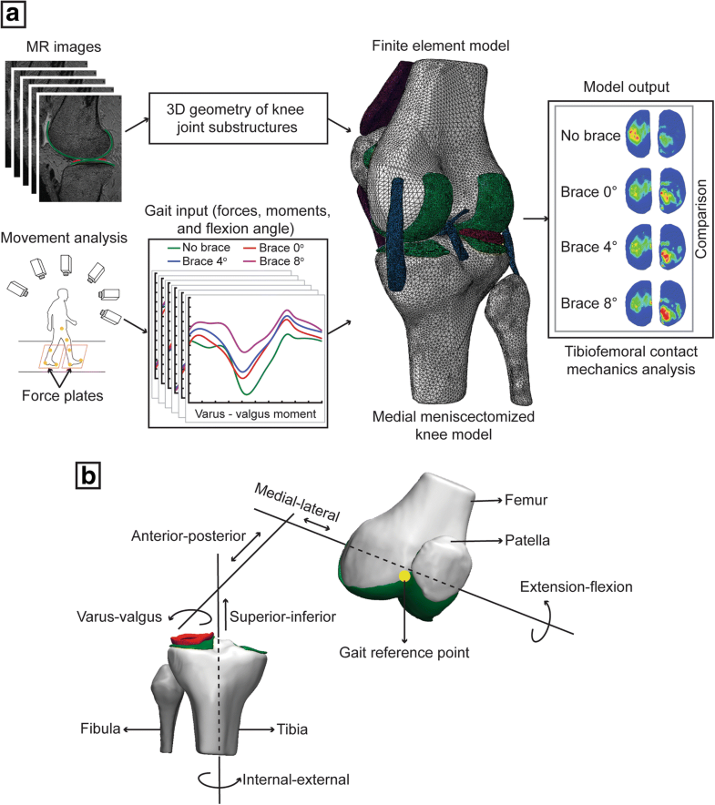 compartments of the knee compartments of the knee