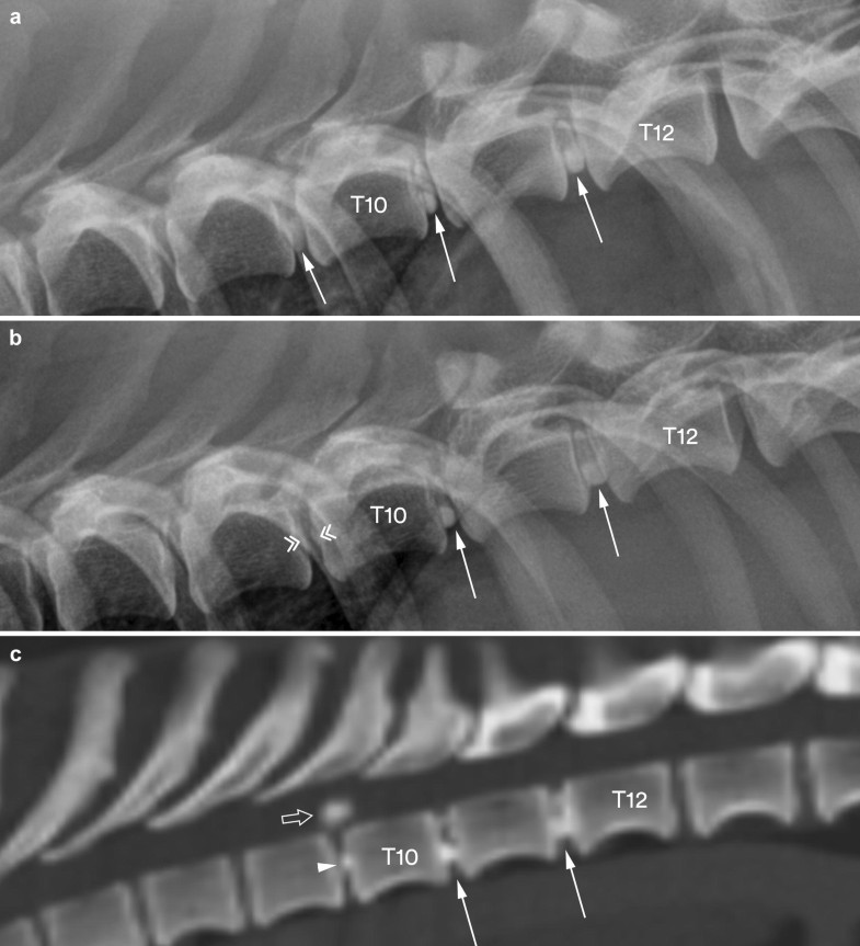 Calcification of extruded intervertebral discs in dachshunds a