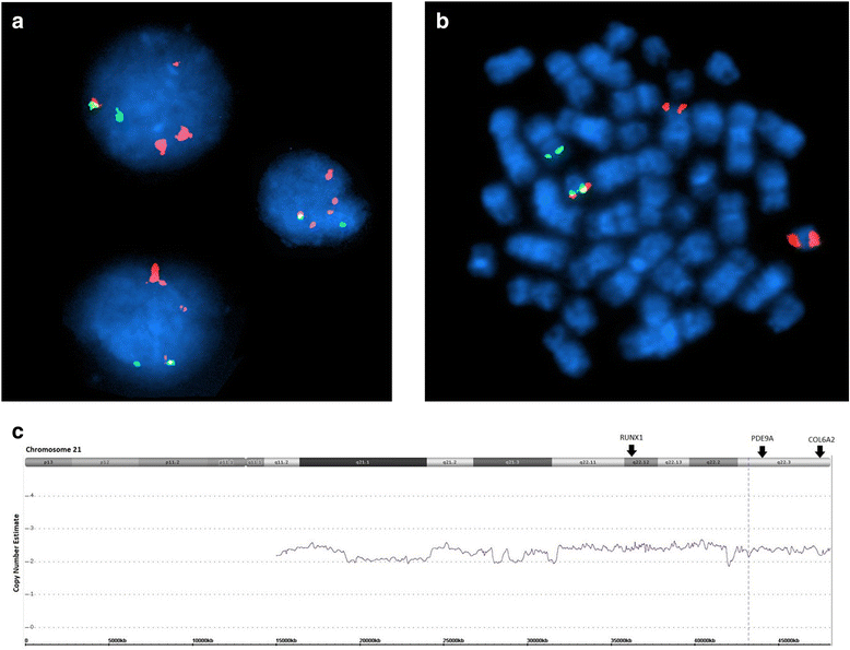 Coexistence of iAMP21 and ETV6-RUNX1 fusion in an adolescent with B ...