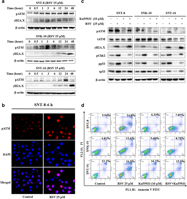 Resveratrol inhibits Extranodal NK/T cell lymphoma through activation
