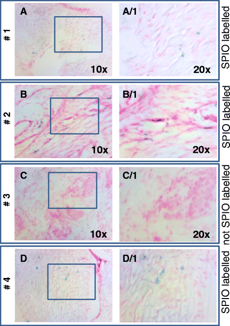 (PDF) Ex vivo MRI cell tracking of autologous mesenchymal 