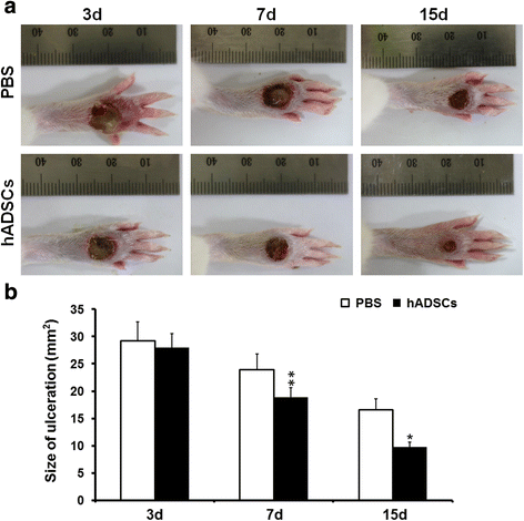 Localization of human adipose-derived stem cells and their effect in ...