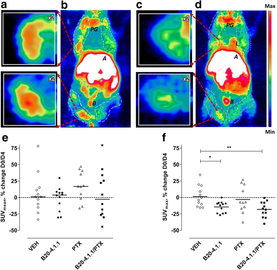Treatment response assessment with (R)[11CPAQ PET in the MMTVPyMT mouse model of breast cancer