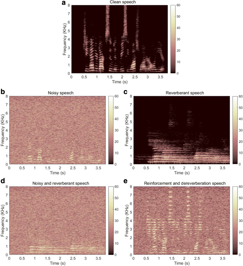 Speech intelligibility improvement in noisy reverberant