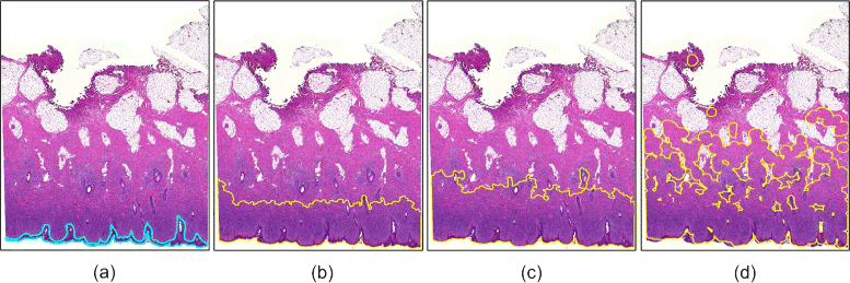 Epidermis segmentation in skin histopathological images based on