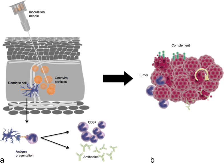 Oncolytic virus immunotherapy: future prospects for oncology | Journal ...