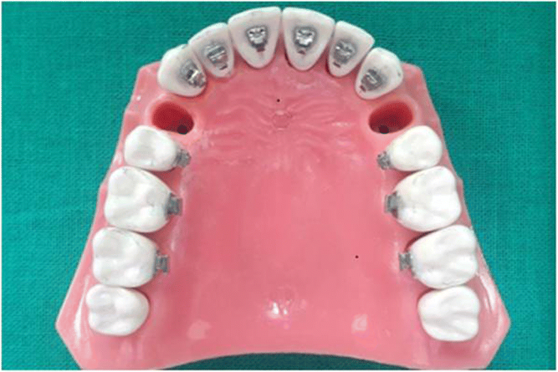 Comparative assessment of the efficacy of closed helical loop and T