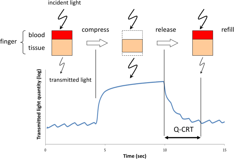 Quantitative capillary refill time predicts sepsis in patients with