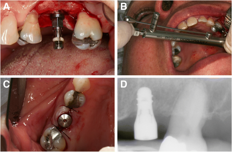 Relation between insertion torque and tactile, visual, and rescaled